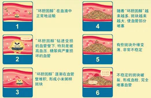 肥胖糖尿病人，當心胰島素抵抗七大危害！
