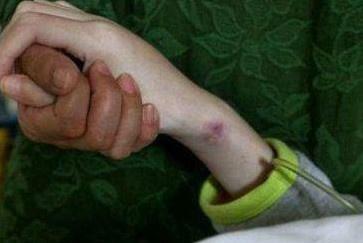 10歲男孩被查出兒童尿毒症，可能是這些原因，寶爸寶媽們都來看看 