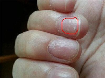 醫生警告：癌細胞最喜歡的3種水果，尤其第一種! 