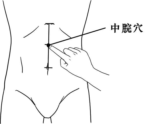 20種病症的針灸取穴及操作手法精華總結（收了吧！）