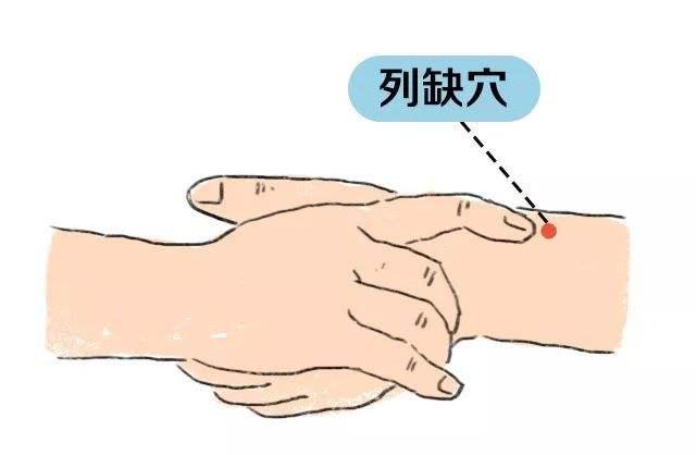 20種病症的針灸取穴及操作手法精華總結（收了吧！）