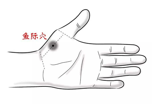 20種病症的針灸取穴及操作手法精華總結（收了吧！）