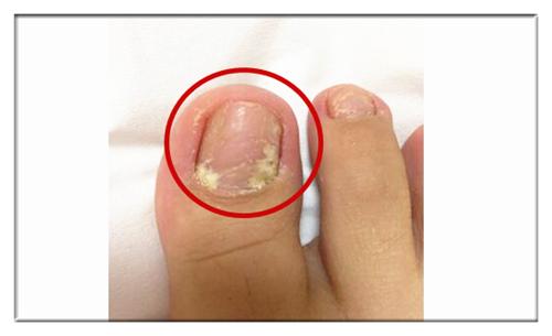 腳部的「這些變化」，都是疾病信號，你注意到了嗎？千萬不要忽視