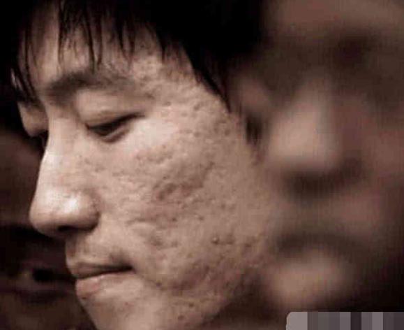 這些「卸妝死」的男星，陳偉霆滿臉痘，黃渤一言難盡，而他滿臉坑
