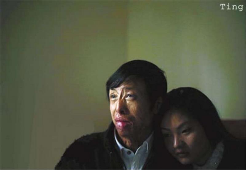 兩次沖入火場救出13條鮮活生命卻慘遭毀容，21歲小夥只能街頭賣唱，沒想到命運從此改變，得到了完美回報