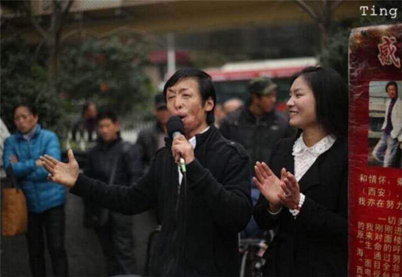 兩次沖入火場救出13條鮮活生命卻慘遭毀容，21歲小夥只能街頭賣唱，沒想到命運從此改變，得到了完美回報