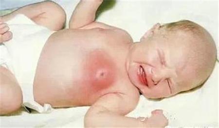 男子倒完垃圾「手臂一塊塊開始腐爛」！麻痺送醫才發現....竟是「被牠咬了一小口」妻子當場崩潰！