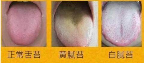 從舌頭一眼看是否癌症體質，癌細胞最怕1種鹼性食物，常吃防癌