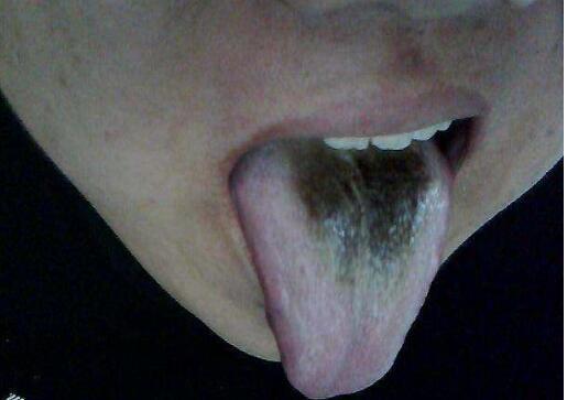 從舌頭一眼看是否癌症體質，癌細胞最怕1種鹼性食物，常吃防癌