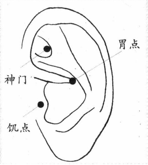 中醫養生小妙招：睡前十分鐘，這樣揉耳朵，3個好處來找你