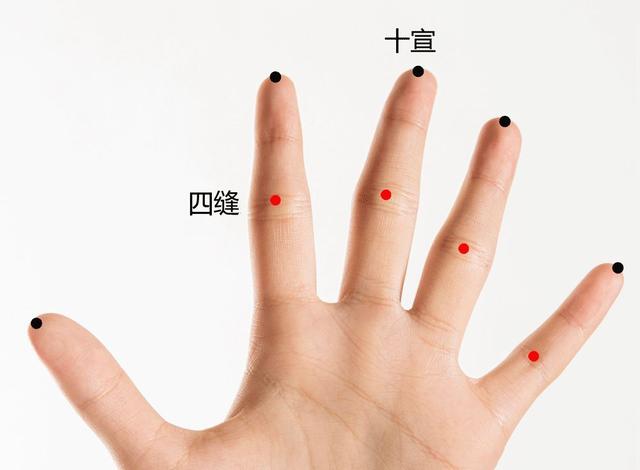 年底聚會多，腹瀉、胃痛、消化不良找上門怎麼辦？