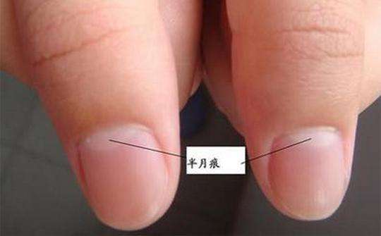 老中醫說: 通過看指甲你就會知道， 可能是患上了糖尿病， 看過都說准！