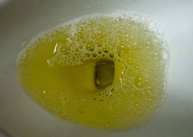 老中醫說: 通過看指甲你就會知道， 可能是患上了糖尿病， 看過都說准！