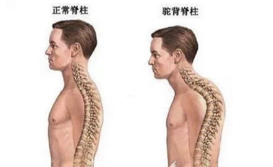 太棒了！只要做這五個動作...背痛，腰痛，頸椎痛都好了！老實做一周我整個人挺起來！ 