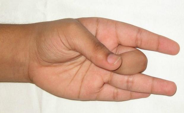 手就能做瑜珈：超簡單「六種手印」解痛、治「濕疹」、助減肥還能「降膽固醇」，不練虧大了！