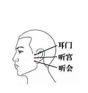 針灸穴位妙計，穴位歌訣讓你輕鬆愛上記穴位