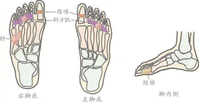 落枕，失枕，項背部酸痛，頸部活動受限？7個手足反射區有效果，收藏