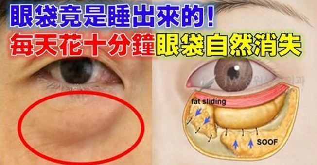 「眼袋」竟是睡出來的！每天只要花10分鐘這樣做，顯老眼袋自然消！ 