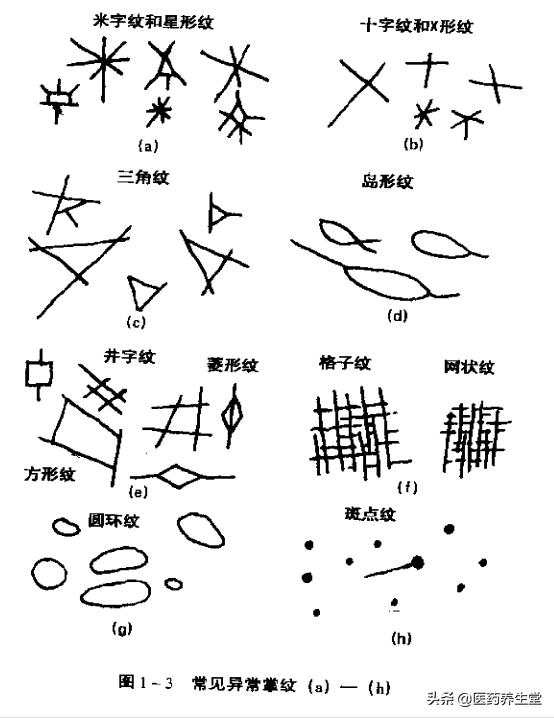 一口氣讀懂中醫手診，通俗易懂！收藏下來吧