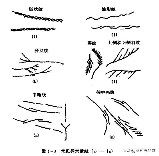一口氣讀懂中醫手診，通俗易懂！收藏下來吧