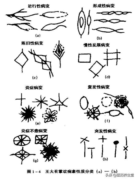 一口氣讀懂中醫手診，通俗易懂！收藏下來吧