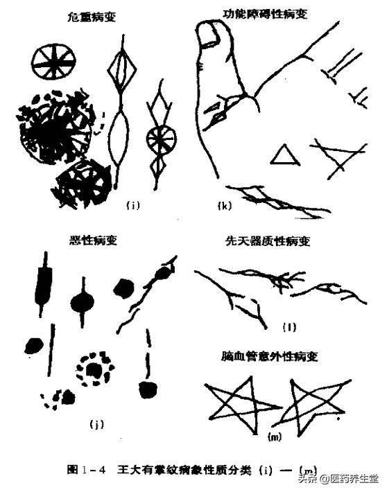 一口氣讀懂中醫手診，通俗易懂！收藏下來吧