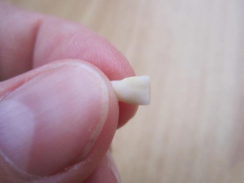 別再把「小孩掉落的乳牙」扔掉了！最新研究證明：關鍵時刻可救自己一命！
