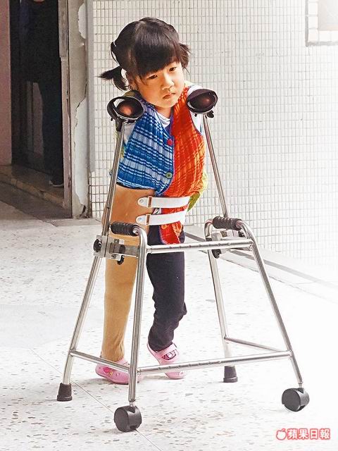 5歲單腳天使笑容催淚！四肢剩左腿「盼上學沒人說奇怪」 「與父相依為命」賣米線淚謝暖心客 