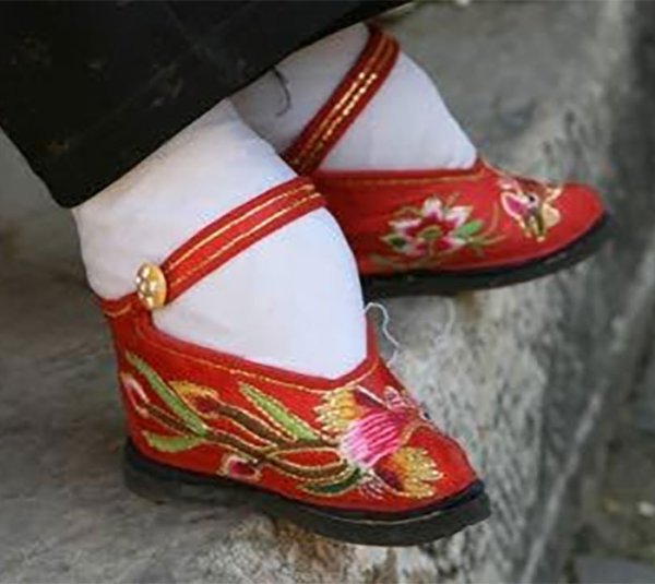 揭開三寸金蓮血淚史！終於願意「鬆開裹腳布」用X光看驚悚到像是P出來！（12張）