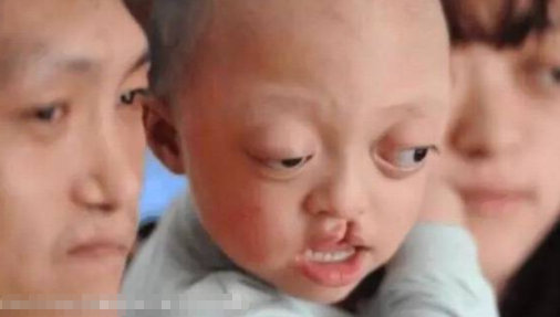 「夫妻倆患有「先天性缺陷」」的圖片搜尋結果