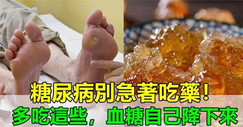 糖尿病人別急著吃藥，每天多吃這些食物，3個月，血糖自己慢慢降下來