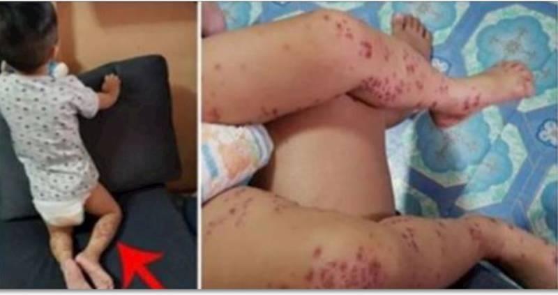 兒子從賣場回家「皮膚紅腫潰爛」！醫生檢查嘆「沒藥可醫」媽媽痛心呼籲：所有家長都要注意