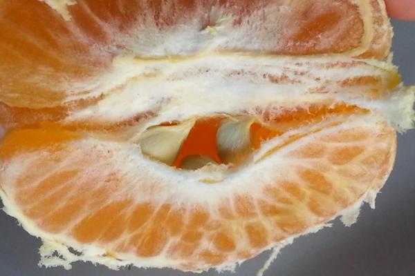 橘子上的白絲能去火？它到底是什麼？