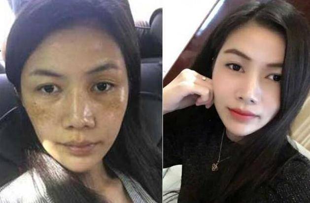 半根黃瓜祛斑法，36歲大姐5天淡斑，一周蛻變水潤豆腐肌！