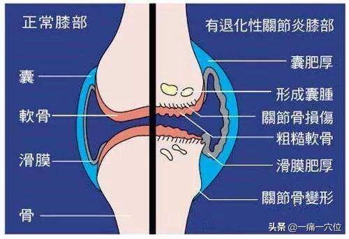 老人學會預防為關鍵，每天掐掐此穴，可預防心臟疾病與膝關節痛！