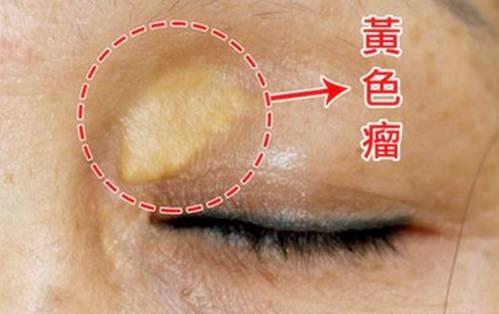 心臟好不好，看「五官」，喝一水、吃二紅、忍三事，心臟會變好