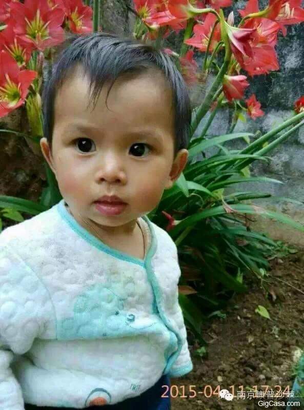 1歲小孩的臉被燙傷，一種「神奇的植物果實」救了孩子！知道了一定要分享！