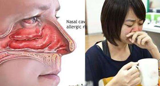 鼻子敏感者或鼻竇炎有救了！「蓮藕紅棗水」，每週喝兩次，可治鼻子過敏，簡單易學，效果好