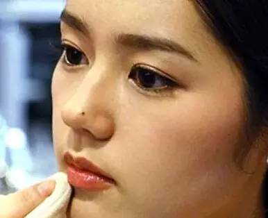 【根據命理解析】女人一定要去掉的9顆兇痣，你中招了嗎？
