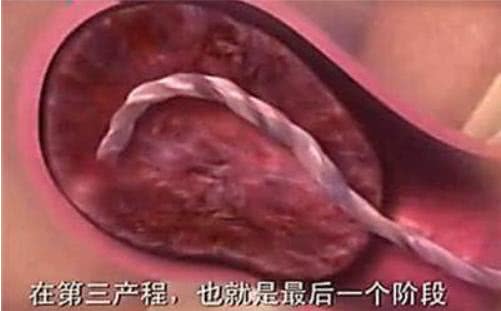 胎兒那麼大，如何從那麼小的產道出來？看完就知道女人有多偉大