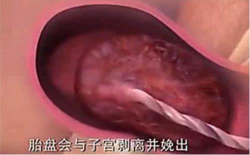 胎兒那麼大，如何從那麼小的產道出來？看完就知道女人有多偉大