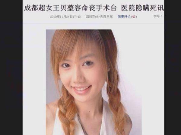 她年僅24歲整容失敗死在手術台上！為了漂亮去整容到底值不值？