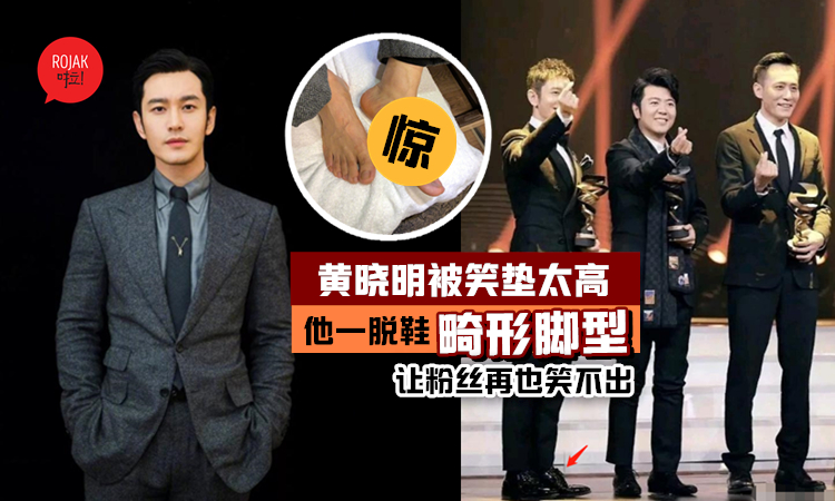 心疼！黃曉明被疑增高鞋墊疊過高, 脫下鞋子露出「畸形腳型」後, 剛剛笑他的粉絲都後悔了！