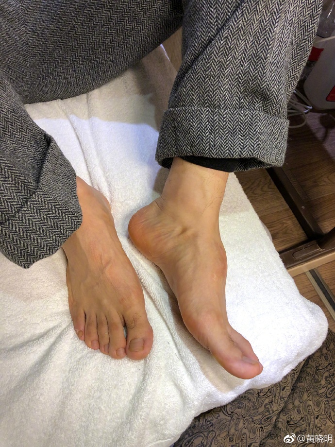 心疼！黃曉明被疑增高鞋墊疊過高, 脫下鞋子露出「畸形腳型」後, 剛剛笑他的粉絲都後悔了！