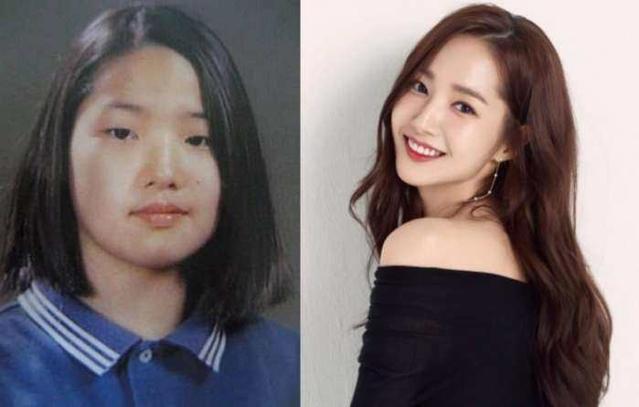 被說整容怪物，遭遇霸凌導致憂鬱13年，韓國女星的出道歷程！