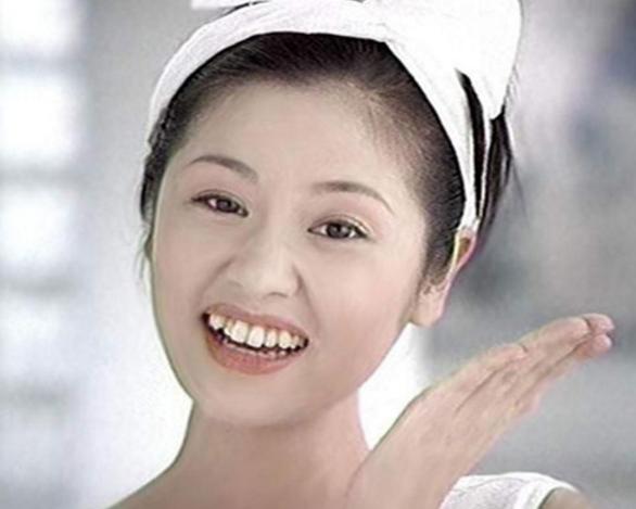 明星矯牙前：林心如又土又村，高圓圓不敢張嘴笑，baby簡直換張臉 