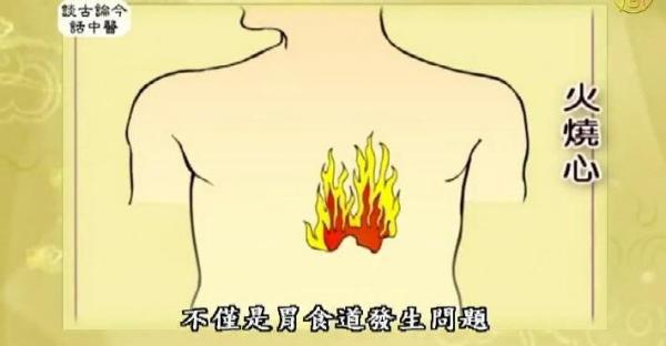 常常胃食道逆流嗎? 只要多吃這幾種食物 就不用買胃藥了! 