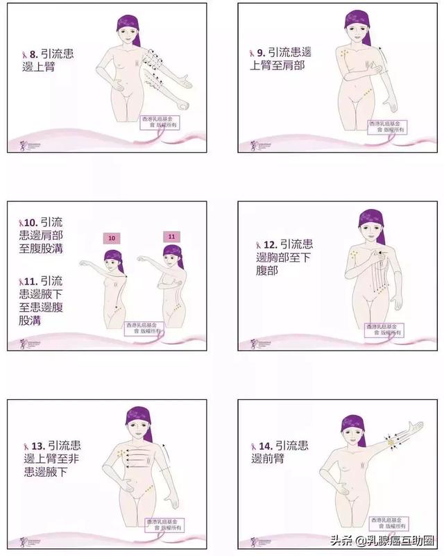 一圖看懂！如何避免乳腺癌術後淋巴水腫