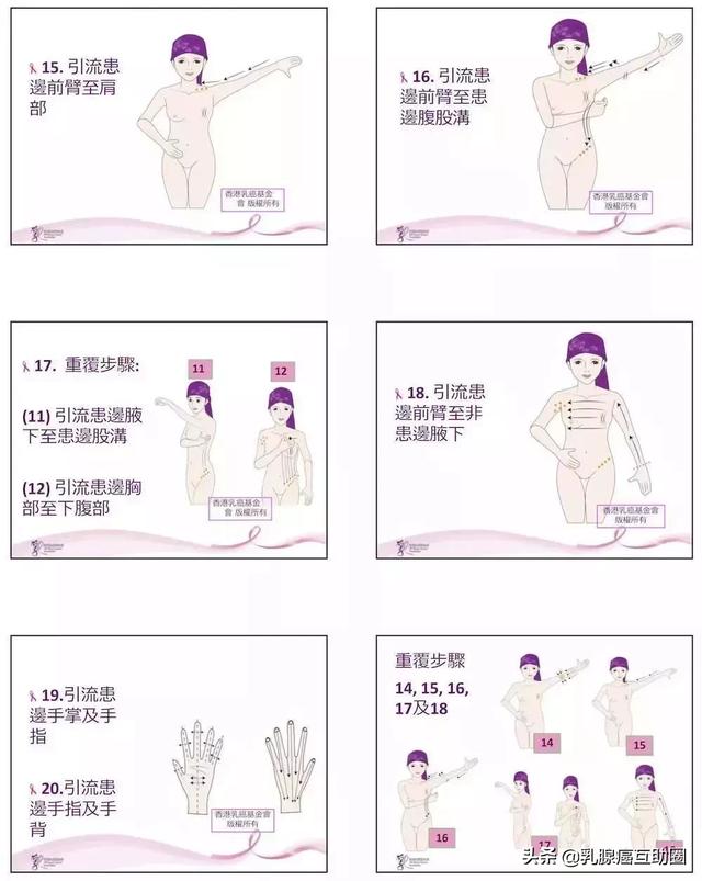 一圖看懂！如何避免乳腺癌術後淋巴水腫