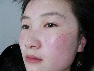 生什麼病，就忌什麼口！這張表留著很有用（珍藏級）